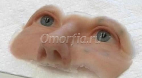 Женщине сделали силиконовое лицо - www.doctorGev.org