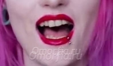 Мои зубы до