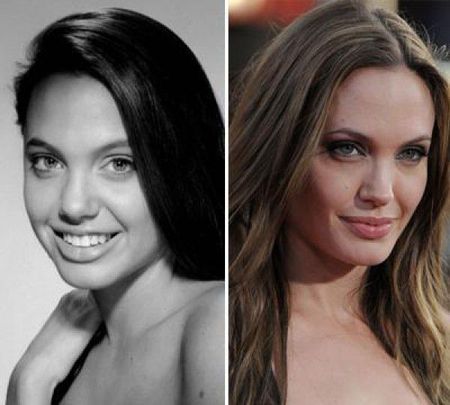 Вся правда о пластики Анджелины Джоли. Что было до и после? Давайте разберемся.