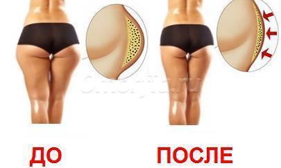 Image title