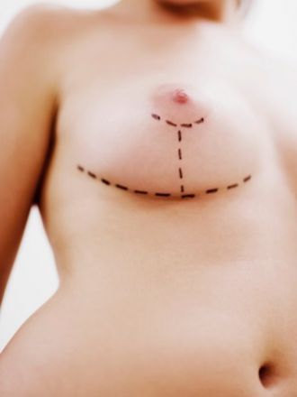 Все, что вам нужно знать о груди и ее размере | Александр Маркушин пластический хирург