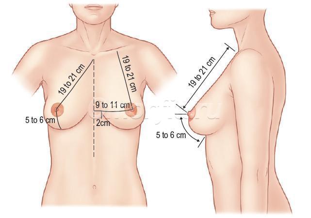 Формула идеальной женской груди – Клиника 